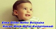 Elma Dilimi Soluk Borusuna Kaçan Minik Murat Alperen Hayatını Kaybetti!